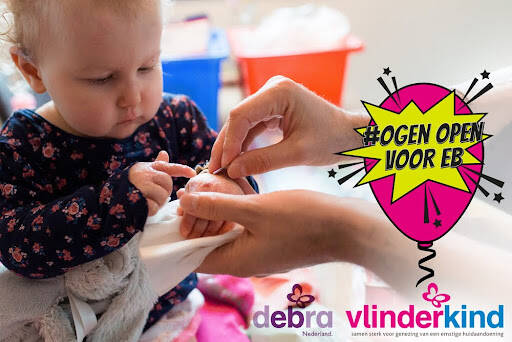 BN'ers steunen massaal campagne #ogenopenvooreb